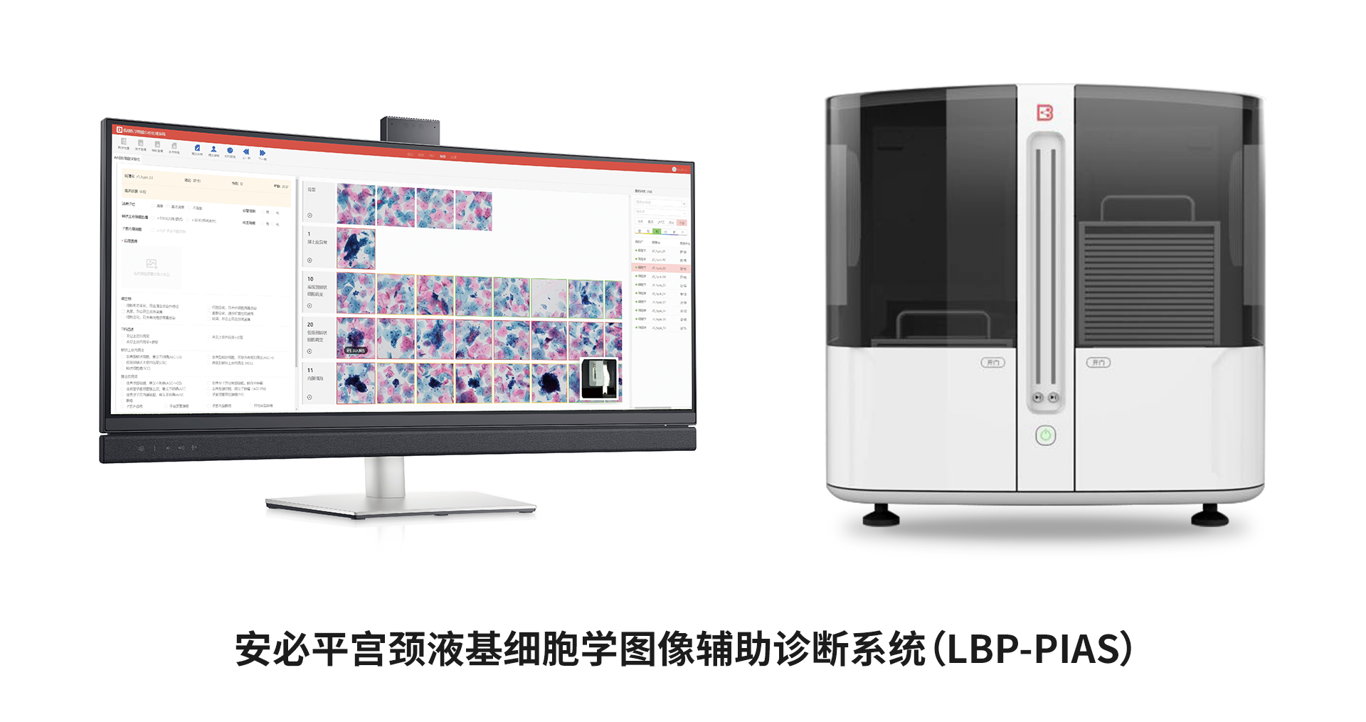 jdb电子游戏平台宫颈液基细胞学图像辅助诊断系统（LBP-PIAS）.png